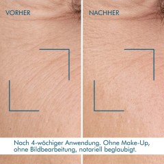 Biotherm Blue Retinol Resurface + Repair Night Serum Blue Retinol Resurface + Восстанавливающая ночная сыворотка